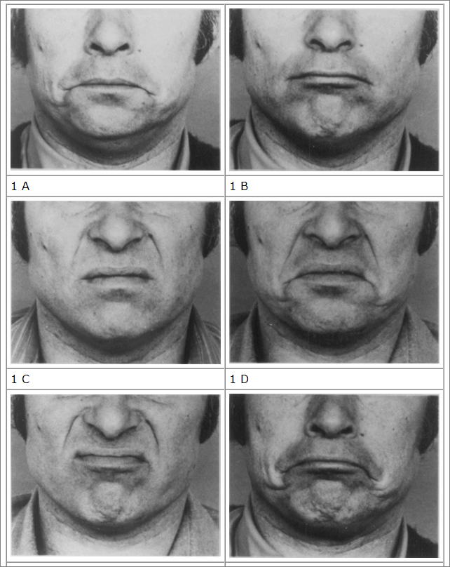 facialmovements